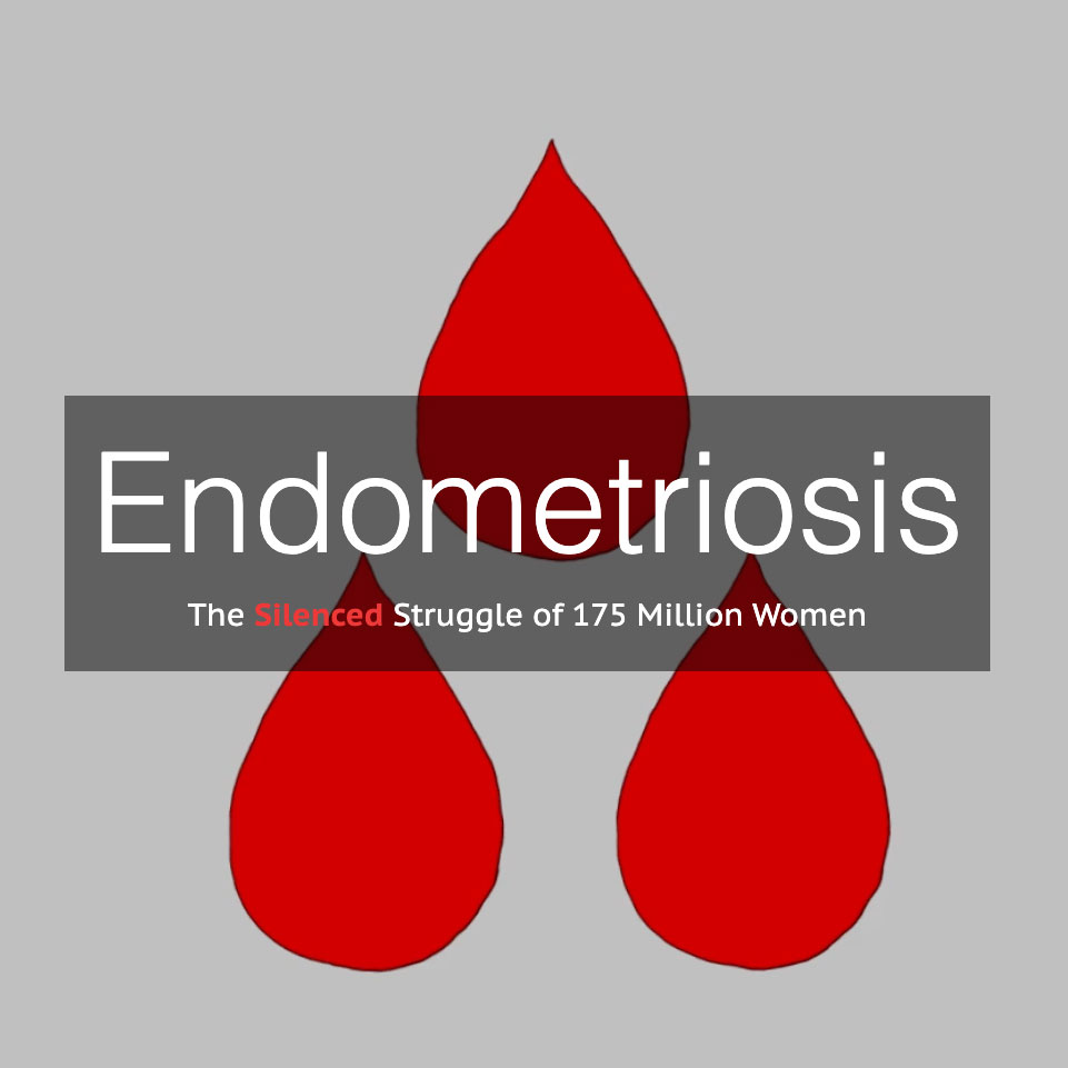 Endometriosis